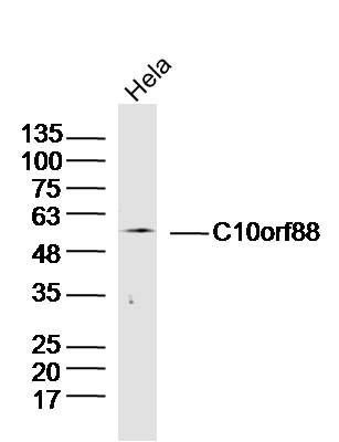 Fig1: Sample: Hela Cell(Human)Lysate at 30 ug; Primary: Anti-C10orf88 at 1/300 dilution; Secondary: IRDye800CW Goat Anti-Rabbit IgG at 1/20000 dilution; Predicted band size: 49kD; Observed band size: 50kD