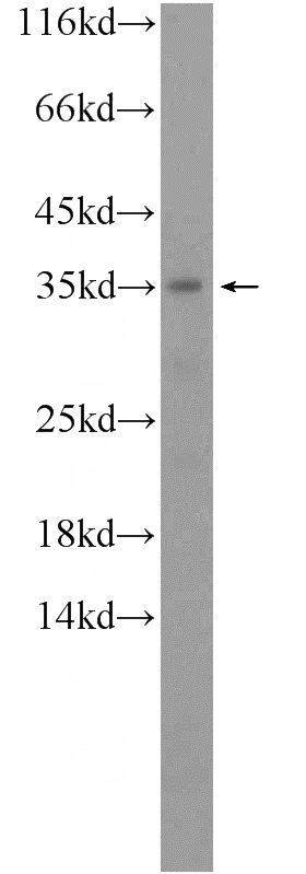 human kidney tissue were subjected to SDS PAGE followed by western blot with Catalog No:107730(ACBD4 Antibody) at dilution of 1:1000