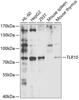 Western blot - TLR10 Polyclonal Antibody 