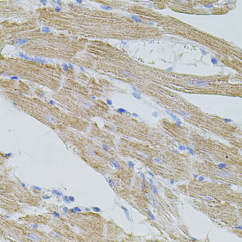 Immunohistochemistry - TRPA1 Polyclonal Antibody 