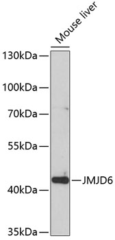 Western blot - JMJD6 Polyclonal Antibody 
