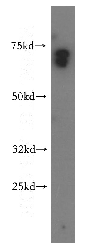 human brain tissue were subjected to SDS PAGE followed by western blot with Catalog No:116362(TSPAN33 antibody) at dilution of 1:400