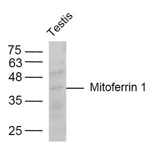 Fig1: Sample:; Testis (Mouse) Lysate at 40 ug; Primary: Anti-Mitoferrin 1 at 1/300 dilution; Secondary: IRDye800CW Goat Anti-Rabbit IgG at 1/20000 dilution; Predicted band size: 37 kD; Observed band size: 37 kD