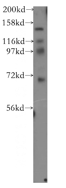 human brain tissue were subjected to SDS PAGE followed by western blot with Catalog No:116394(NTRK3 antibody) at dilution of 1:500