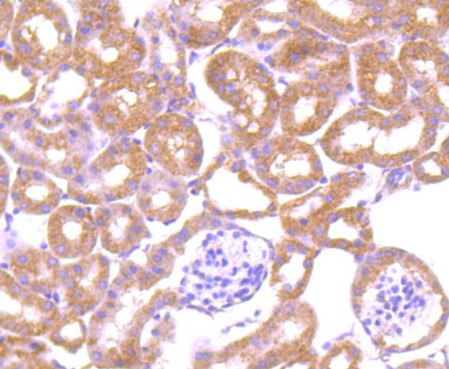 Fig3: Immunohistochemical analysis of paraffin-embedded mouse kidney tissue using anti-LRRK1 antibody. Counter stained with hematoxylin.