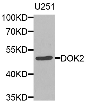 Western blot - DOK2 Polyclonal Antibody 