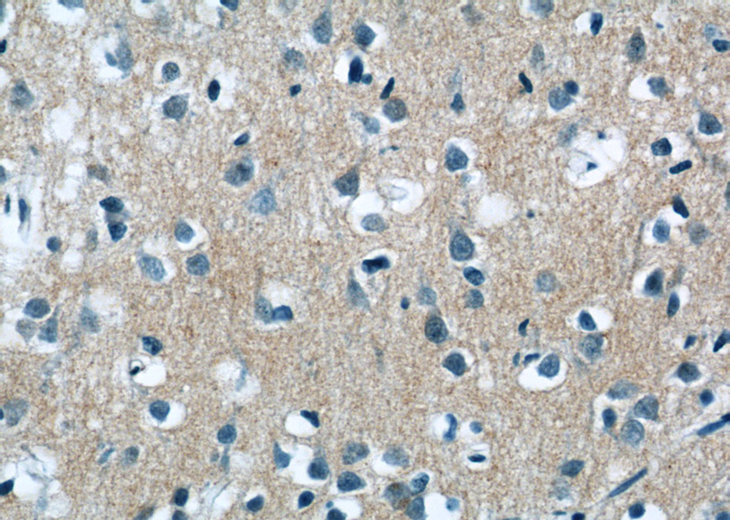Immunohistochemistry of paraffin-embedded human brain tissue slide using Catalog No:113124(NCDN Antibody) at dilution of 1:50 (under 40x lens)