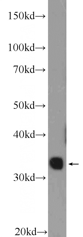 fetal human brain tissue were subjected to SDS PAGE followed by western blot with Catalog No:116216(TPRX1 Antibody) at dilution of 1:600