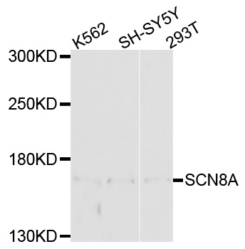 Western blot - SCN8A Polyclonal Antibody 