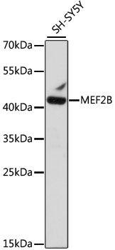 Western blot - MEF2B Polyclonal Antibody 