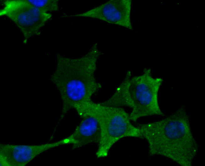 Fig4: ICC staining DLL4 in PMVEC cells (green). The nuclear counter stain is DAPI (blue). Cells were fixed in paraformaldehyde, permeabilised with 0.25% Triton X100/PBS.