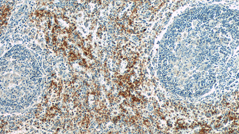 Immunohistochemistry of paraffin-embedded human spleen tissue slide using Catalog No:111055(GP9 Antibody) at dilution of 1:50 (under 10x lens)