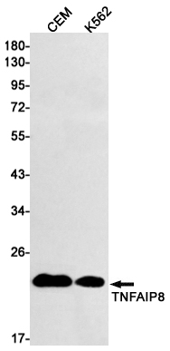 Western blot detection of TNFAIP8 in CEM,K562 cell lysates using TNFAIP8 Rabbit mAb(1:1000 diluted).Predicted band size:23kDa.Observed band size: 21-23kDa.