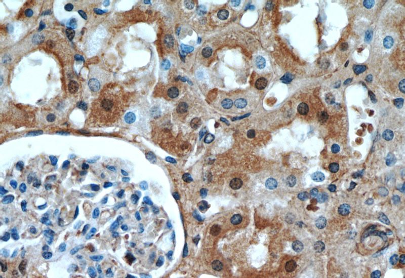 Immunohistochemical of paraffin-embedded human kidney using Catalog No:110752(FXR1 antibody) at dilution of 1:50 (under 40x lens)