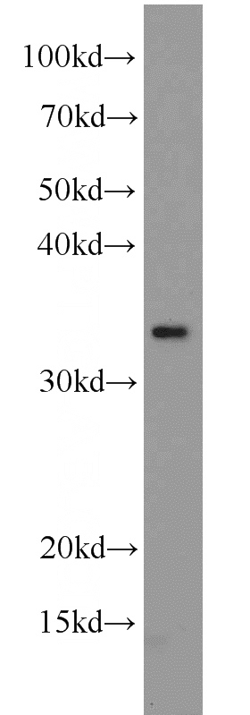 mouse heart tissue were subjected to SDS PAGE followed by western blot with Catalog No:113598(PARVA antibody) at dilution of 1:500