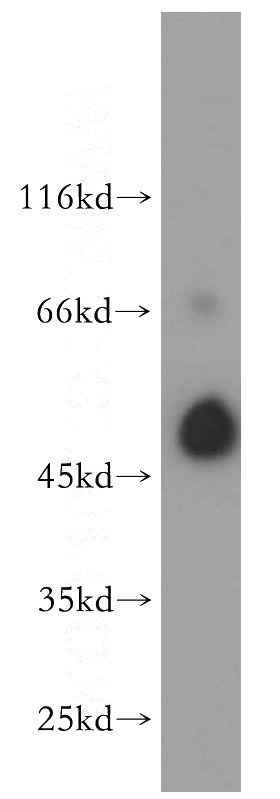 HeLa cells were subjected to SDS PAGE followed by western blot with Catalog No:107979(ALG1 antibody) at dilution of 1:300