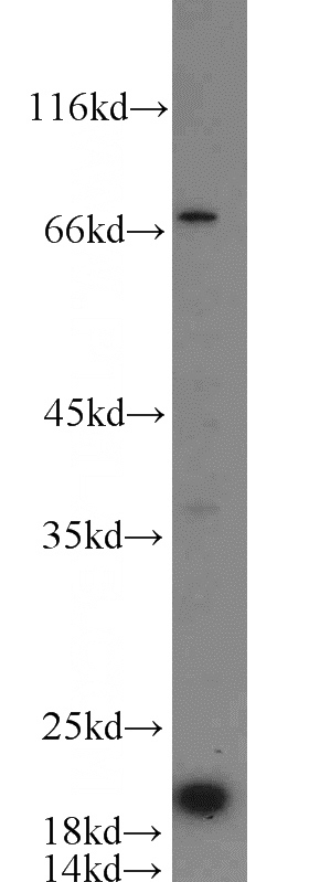 HepG2 cells were subjected to SDS PAGE followed by western blot with Catalog No:109319(CIRBP antibody) at dilution of 1:1000