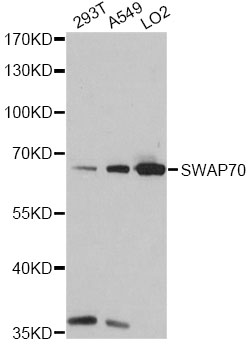 Western blot - SWAP70 Polyclonal Antibody 
