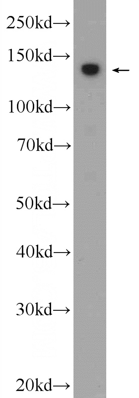 Jurkat cells were subjected to SDS PAGE followed by western blot with Catalog No:114980(SBNO1 Antibody) at dilution of 1:600