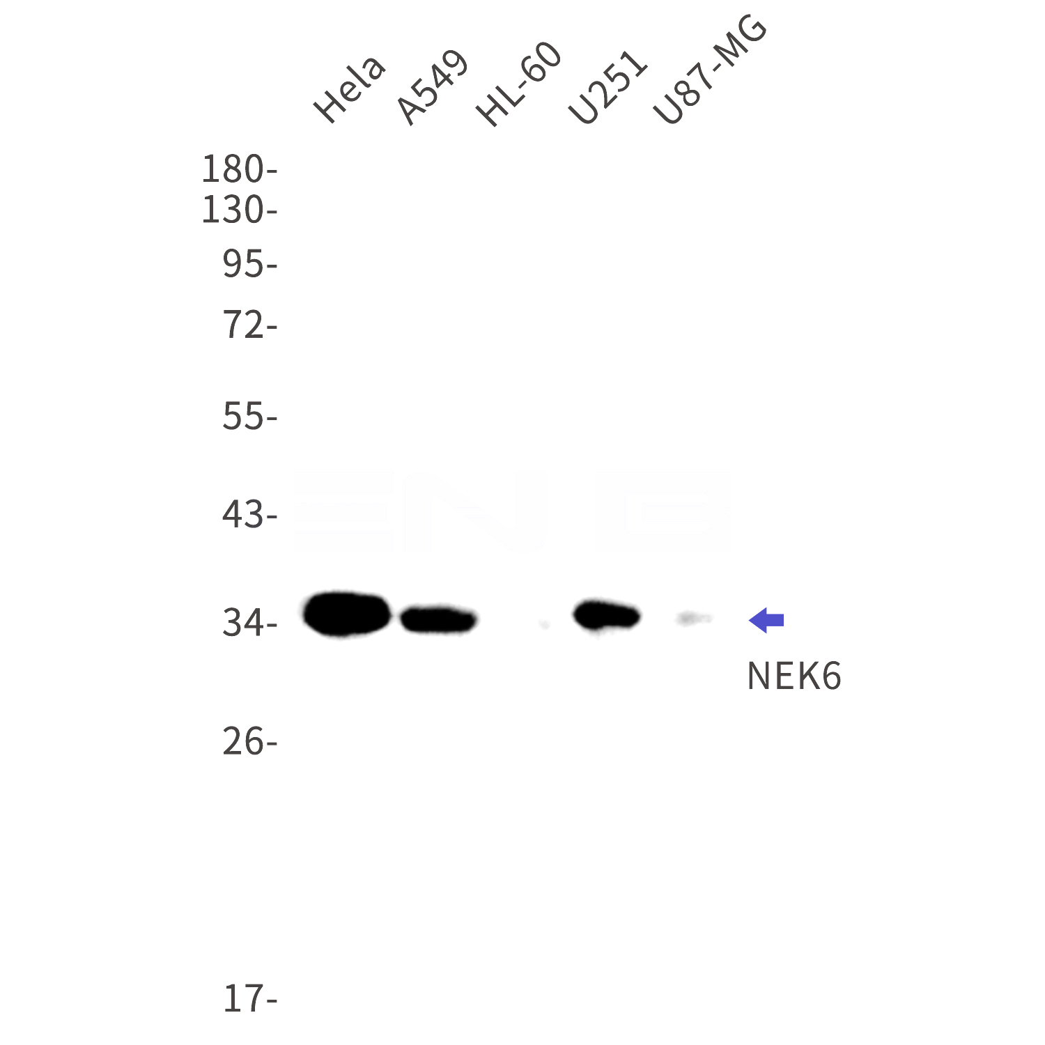 Western blot detection of NEK6 in Hela,A549,HL-60,U251,U87-MG cell lysates using NEK6 Rabbit mAb(1:1000 diluted).Predicted band size:36kDa.Observed band size:36kDa.