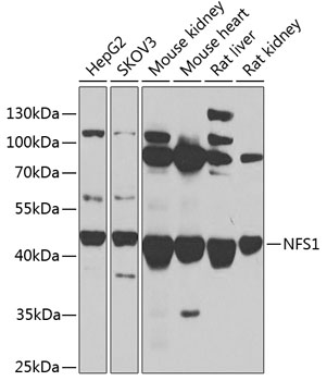 Western blot - NFS1 Polyclonal Antibody 