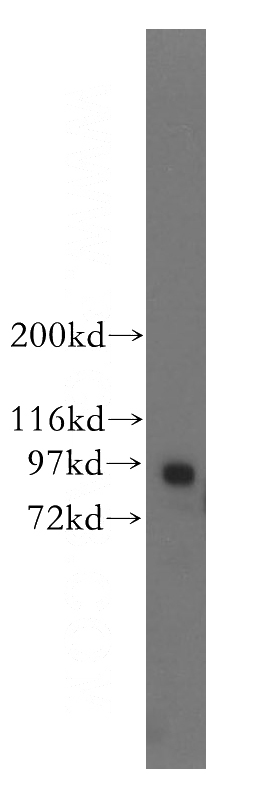 mouse testis tissue were subjected to SDS PAGE followed by western blot with Catalog No:114473(RASEF antibody) at dilution of 1:300