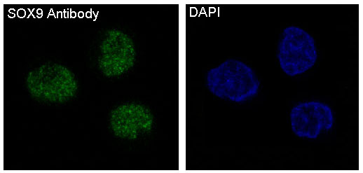 Immunofluorescent analysis of SW480 cells, using SOX9 Antibody .
