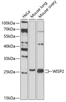 Western blot - WISP2 Polyclonal Antibody 