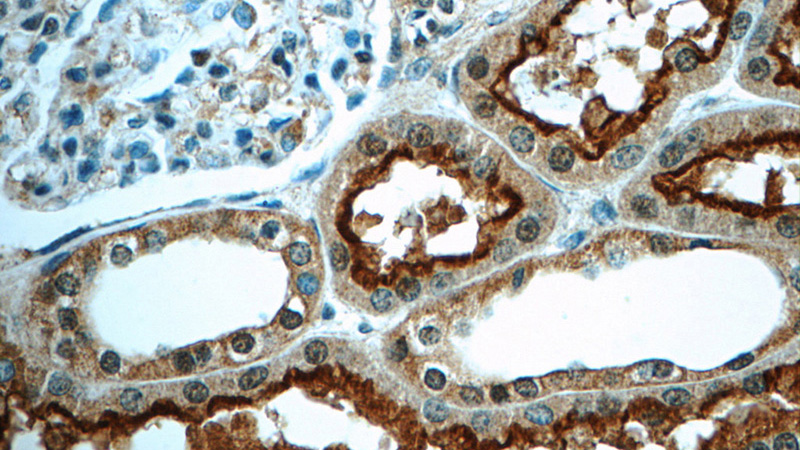 Immunohistochemistry of paraffin-embedded human kidney tissue slide using Catalog No:113320(SLC22A5 Antibody) at dilution of 1:50 (under 40x lens)