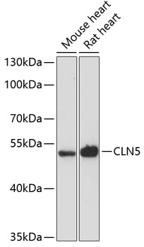 Western blot - CLN5 Polyclonal Antibody 