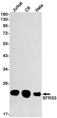 Western blot detection of SFRS3 in Jurkat,C6,Hela cell lysates using SFRS3 Rabbit mAb(1:1000 diluted).Predicted band size:19kDa.Observed band size:19kDa.