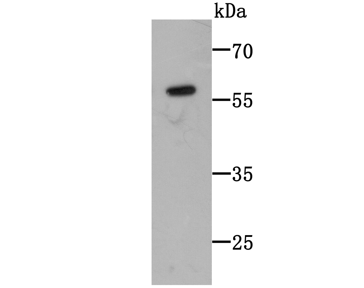 Fig1: Western blot analysis of C14orf93 on C14orf93-GST recombinant protein lysate using anti-C14orf93 antibody at 1/1,000 dilution.