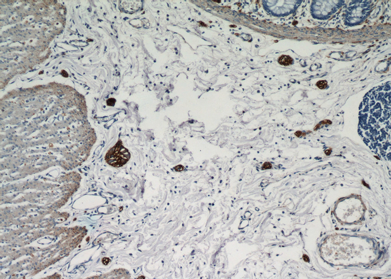 Immunohistochemical of paraffin-embedded human colon using Catalog No:113027(NCAM1 antibody) at dilution of 1:50 (under 10x lens)