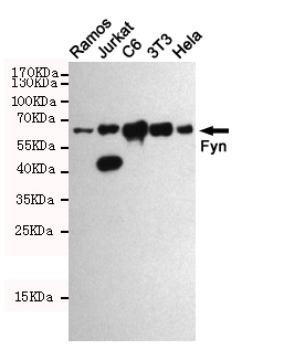 Western blot analysis of extracts from Ramos,Jurkat,C6,3T3 and Hela cell lysates using Fyn Rabbit pAb (1:1000 diluted).Predicted band size:59kDa.Observed band size:45-59kDa.