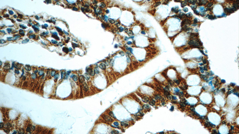 Immunohistochemistry of paraffin-embedded human small intestine tissue slide using Catalog No:111817(PLA2G6 Antibody) at dilution of 1:50 (under 40x lens)