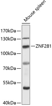 Western blot - ZNF281 Polyclonal Antibody 