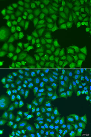 Immunofluorescence - TIRAP Polyclonal Antibody 