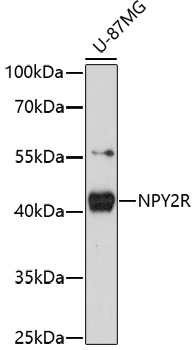 Western blot - NPY2R Polyclonal Antibody 