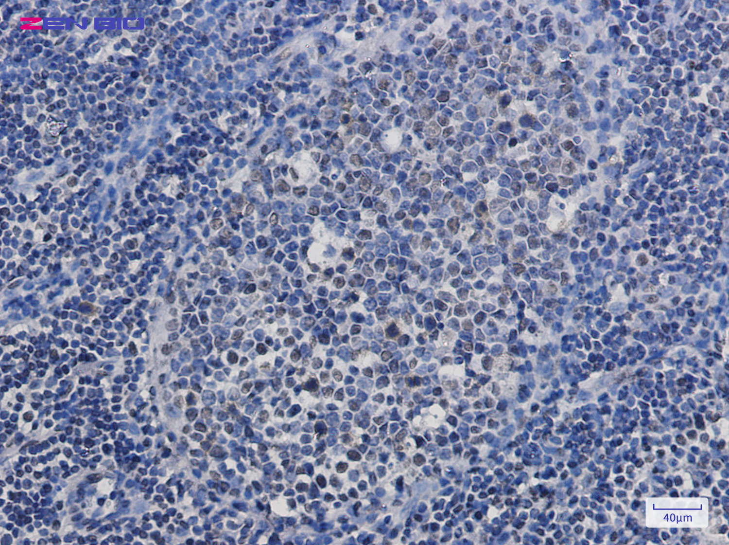 Immunohistochemistry of TAF15 in paraffin-embedded Human tonsil using TAF15 Rabbit pAb at dilution 1/50