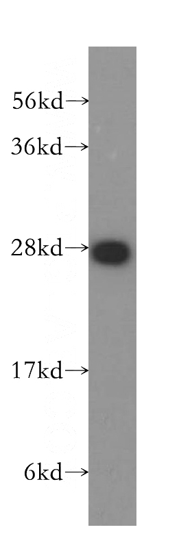 HeLa cells were subjected to SDS PAGE followed by western blot with Catalog No:114266(PGDS antibody) at dilution of 1:500
