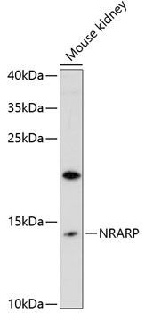Western blot - NRARP Polyclonal Antibody 