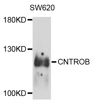 Western blot - CNTROB Polyclonal Antibody 