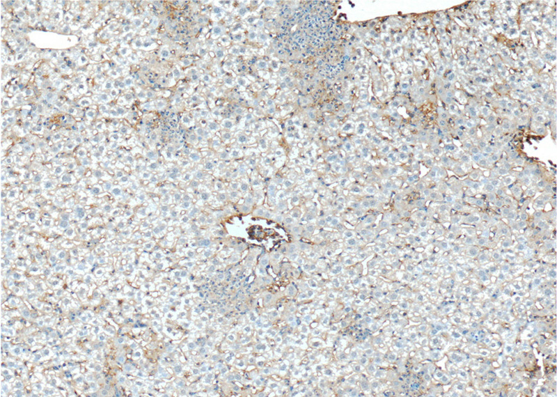 Immunohistochemistry of paraffin-embedded mouse liver tissue slide using Catalog No:111586(Icam1 Antibody) at dilution of 1:200 (under 10x lens)