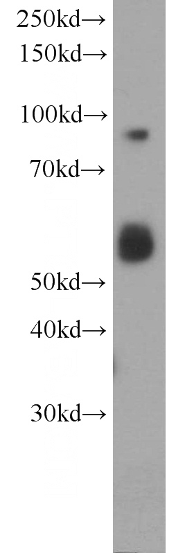 HeLa cells were subjected to SDS PAGE followed by western blot with Catalog No:114708(RIN1 antibody) at dilution of 1:1000