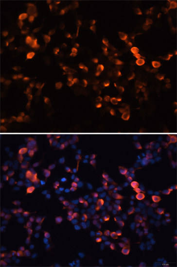 Immunofluorescence - Mouse anti GFP-Tag mAb 