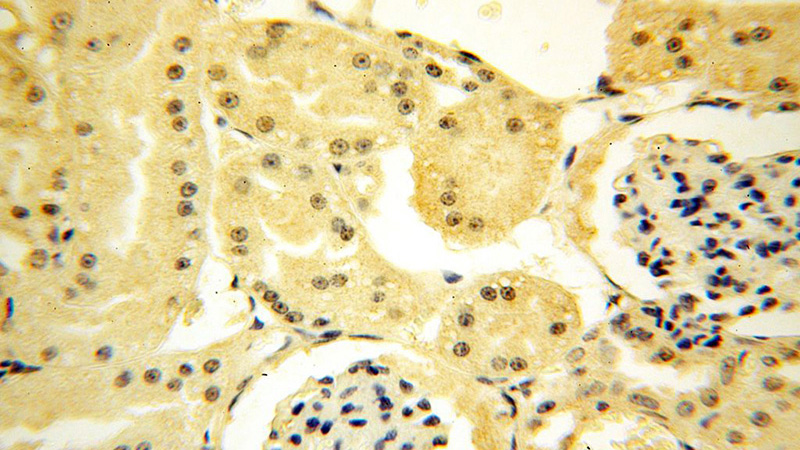 Immunohistochemical of paraffin-embedded human kidney using Catalog No:115888(TBX2 antibody) at dilution of 1:100 (under 40x lens)