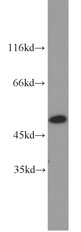 K-562 cells were subjected to SDS PAGE followed by western blot with Catalog No:107707(ACTL6A antibody) at dilution of 1:1000