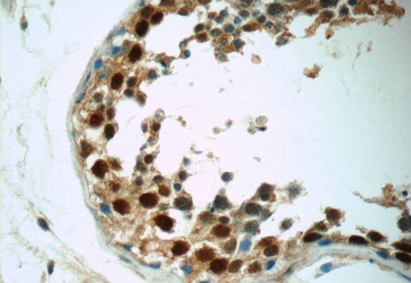 Immunohistochemistry of paraffin-embedded human testis tissue slide using Catalog No:117005(ZNF571 Antibody) at dilution of 1:50 (under 40x lens)