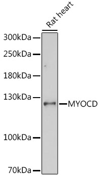 Western blot - MYOCD Polyclonal Antibody 