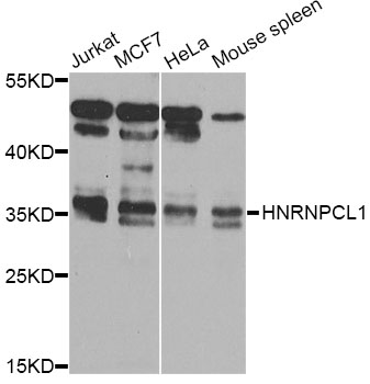Western blot - HNRNPCL1 Polyclonal Antibody 